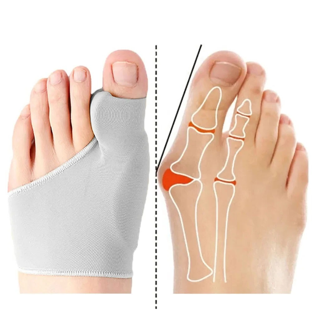 Ankle Brace Sock - 1/2 Çift Ayak Ayırıcı Halluks Valgus